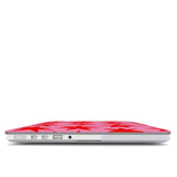 Cherry Star Pop - MacBook Cover