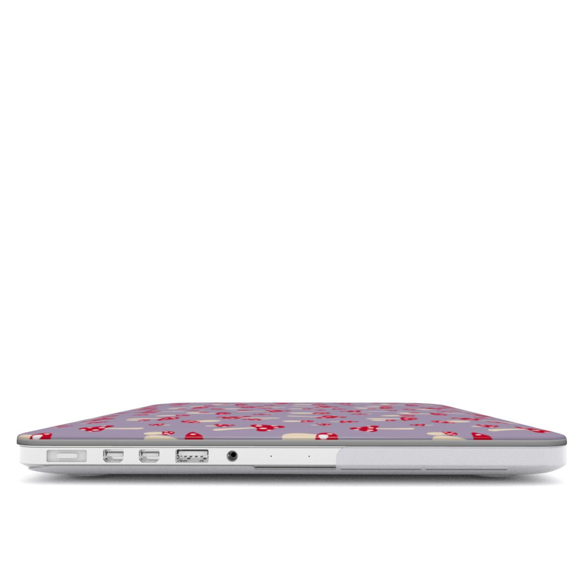 Magic Meadow - MacBook Cover