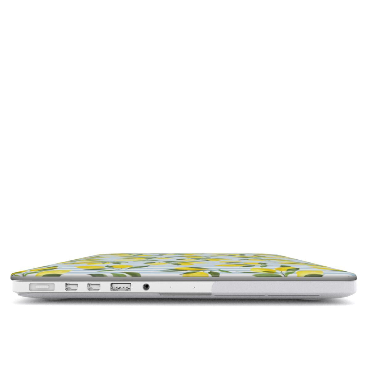 Capri Days - MacBook Cover