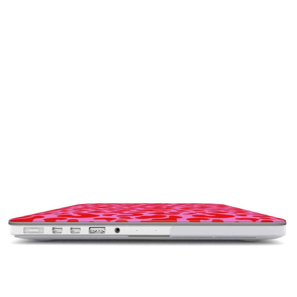 Candy Leopard - MacBook Case