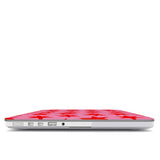 Cherry Star Pop - MacBook Cover