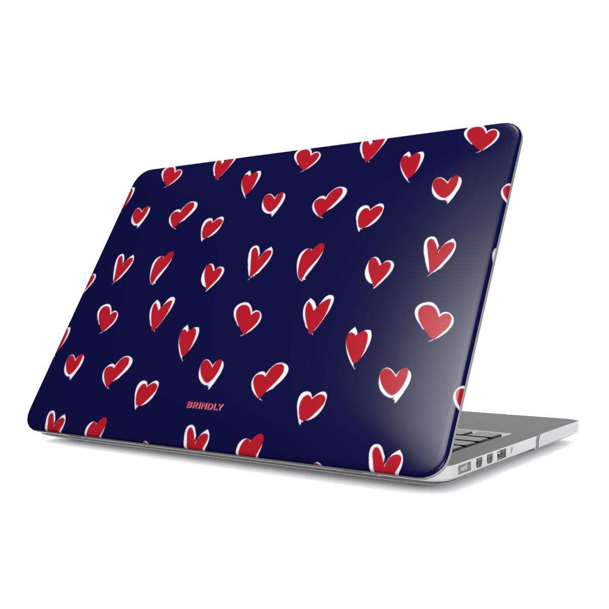 Love Struck - MacBook Case