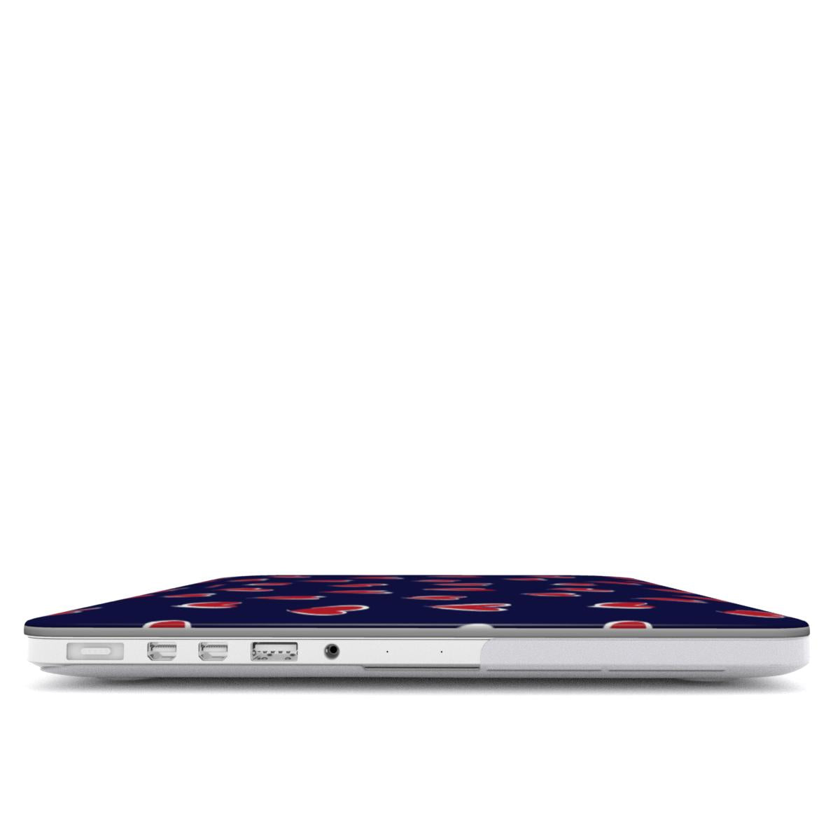 Love Struck - MacBook Case