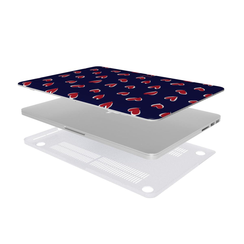 Love Struck - MacBook Case