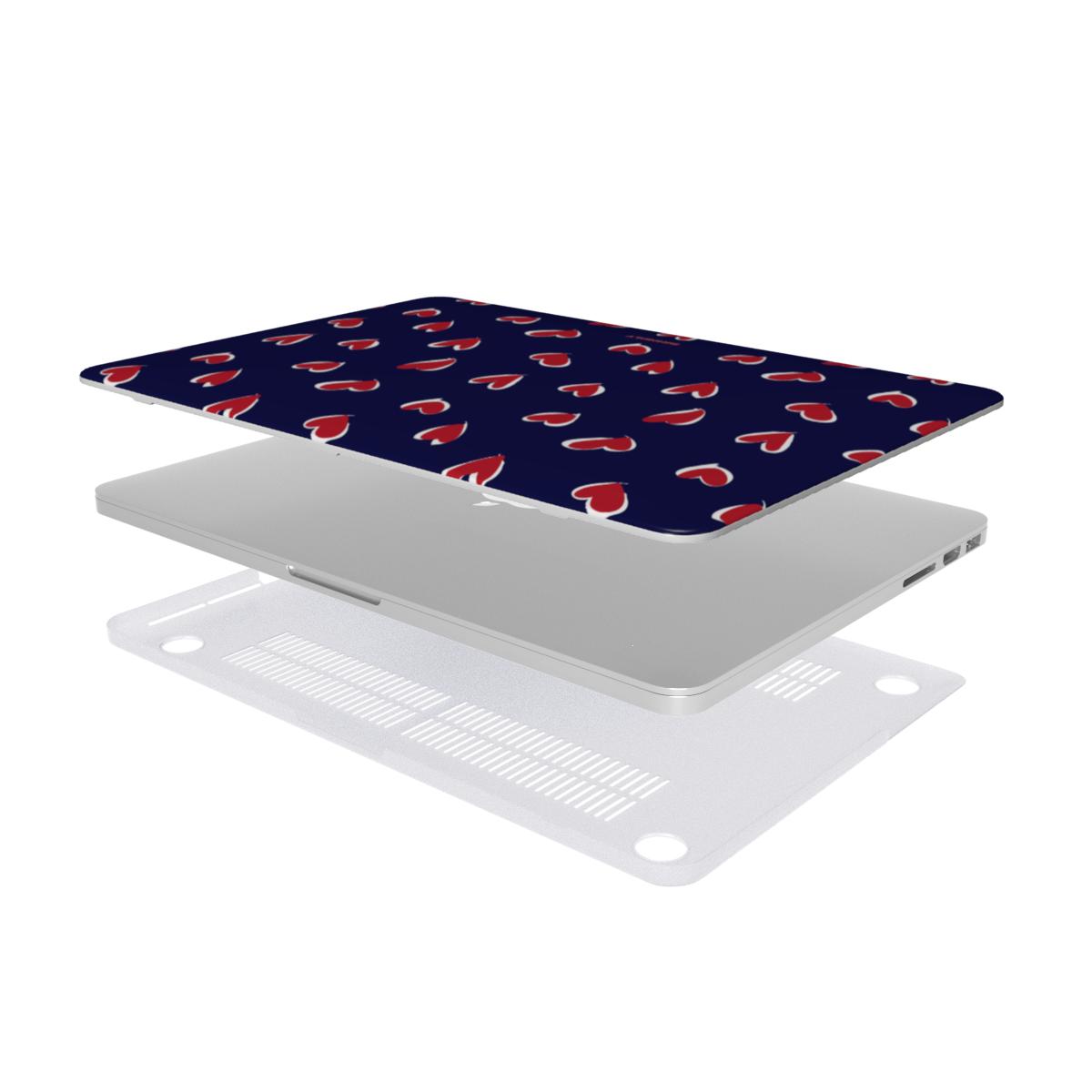 Love Struck - MacBook Case